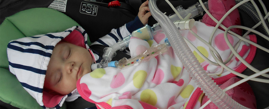A baby sleeping peacefully in a striped hooded sweatshirt and a polka-dot blanket hooked up to medical equipment.